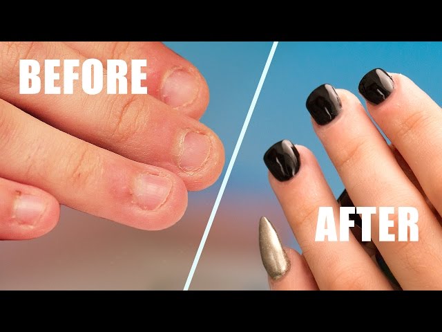 Fix Short Bitten Nails with Acrylic