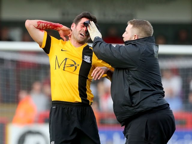 Injury: Southend United's Michael Timlin in the wars at Stevenage