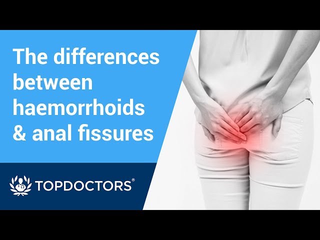 What’s the difference between haemorrhoids and anal fissures?