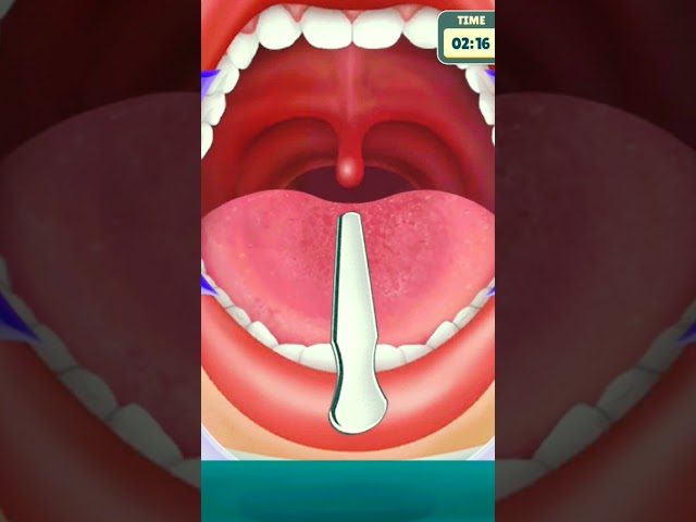 treatment 🔥🔥 #asmr #treatment #shorts #short #games #viral