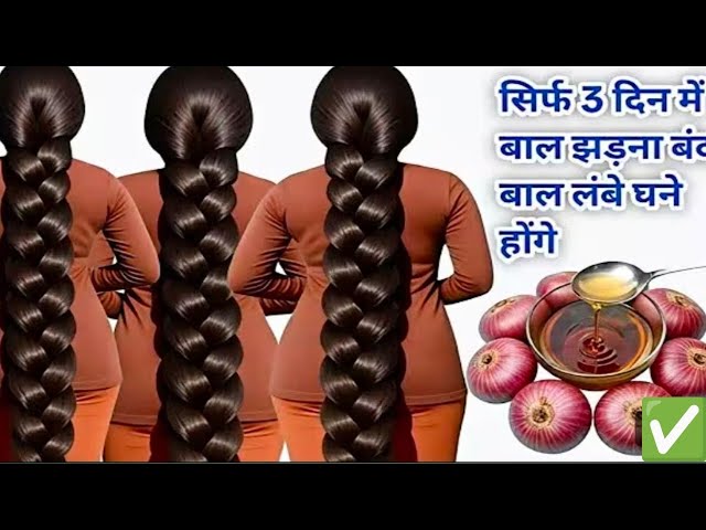 Onion Hair Growth Oil for Double Hair Growth/Home Remedy for Long Thick Hair 