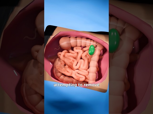 Woman Vomits Poop 🤮