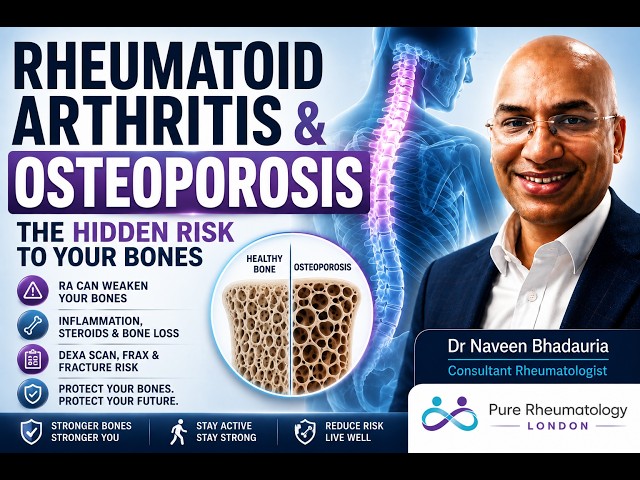 Rheumatoid Arthritis & Osteoporosis: The Hidden Risk to Your Bones