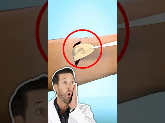 ER Doctor REACTS to Growing an Ear in Your Arm (Zack D. Films)