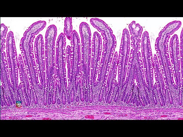 From Biopsy to Microscopy - Tissue processing for light microscopy