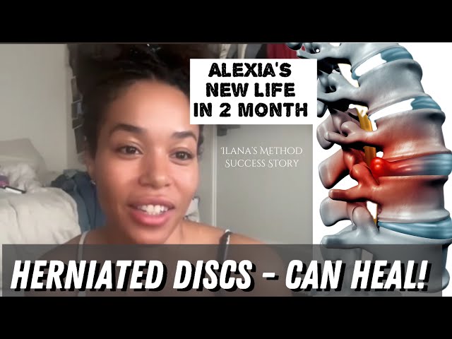 Bulging/Herniated Discs - Can Heal!