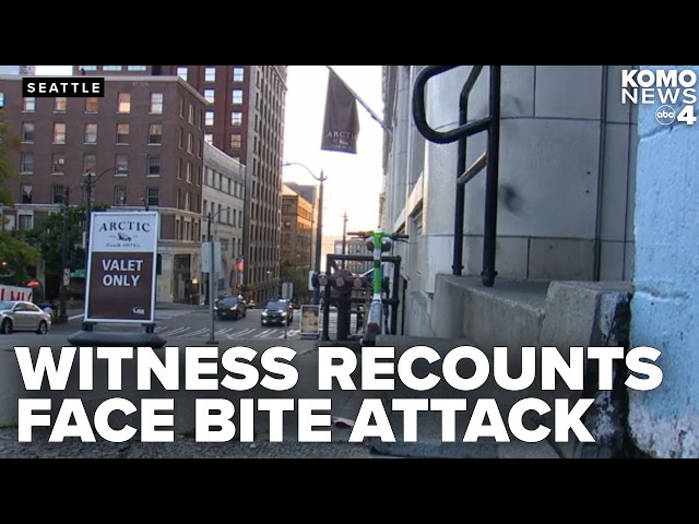 Valet intervened as suspect bit off woman's forehead in downtown Seattle attack