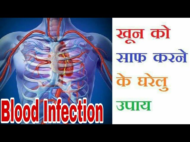 Blood infection In Hindi || खून को साफ करने के घरेलू उपाय || Knowledge TV