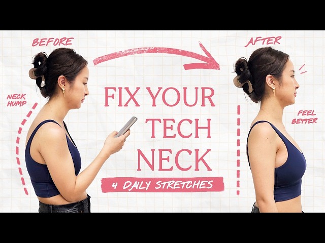 I fixed my BAD posture with 4 easy stretches *expert approved*