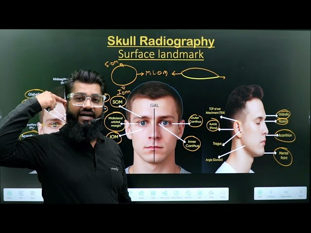 Skull Surface Landmark and Lines || Part -1 || Radiographic Technique || Radiography Made Easy ||