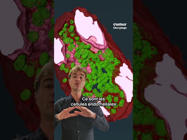 Meningitis: The 3D Journey