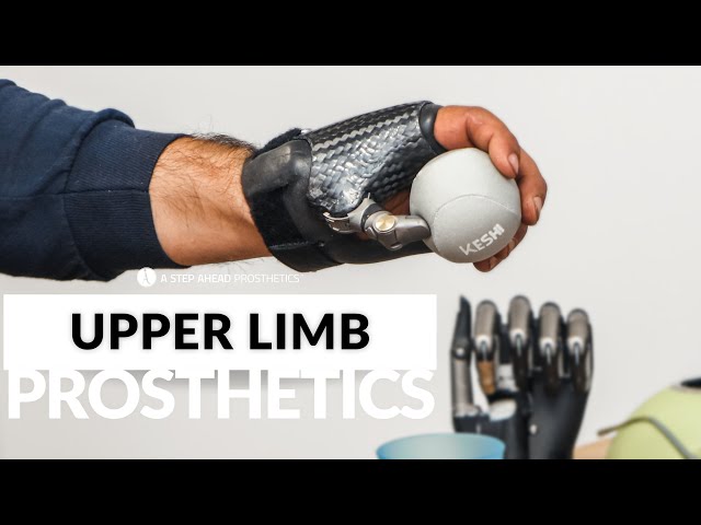 Upper Extremity Prosthetic Users| Limb Difference
