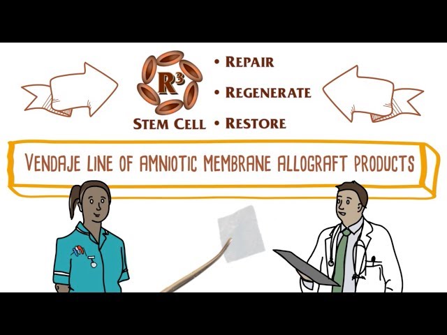 Amniotic Membrane Allograft from R3 Stem Cell