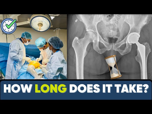 How long does hip replacement surgery take?कितना टाइम लगता है हिप रिप्लेसमेंट में ?#drpankajwalecha