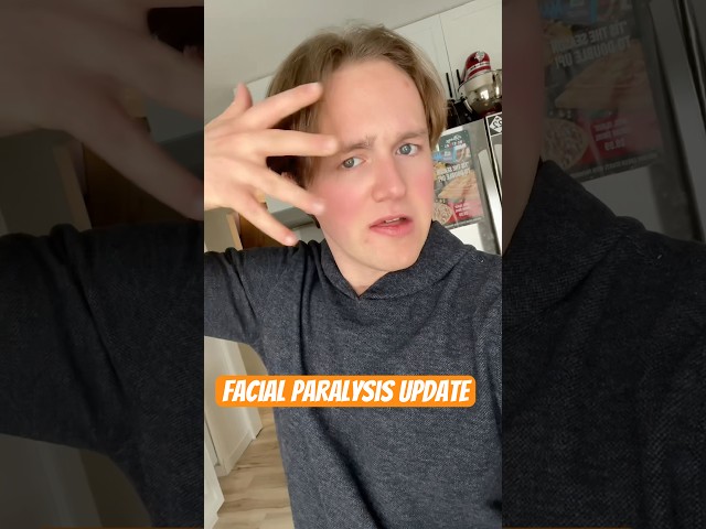 My face is almost fully recovered!! I will start making tutorials again! #fyp #vr  #gamedev