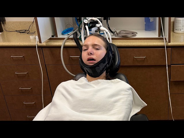 Had my wisdom teeth removed ...