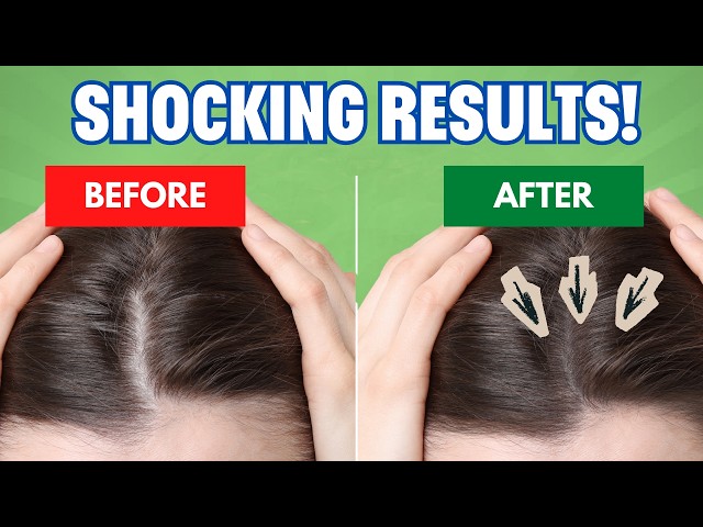 Moringa For Hair Loss? | What The Science Says.