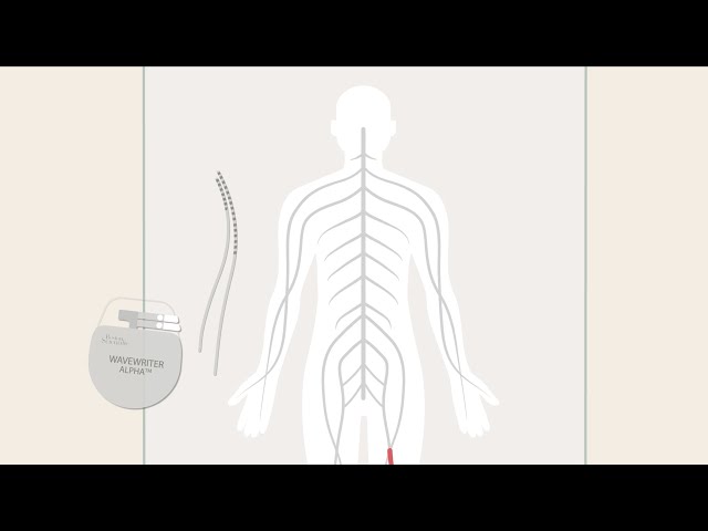 Boston Scientific - How SCS Works