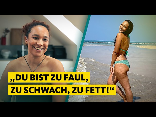 28.000 € für ein normales Leben: Josys Kampf gegen Lipödem | Quarks Doku
