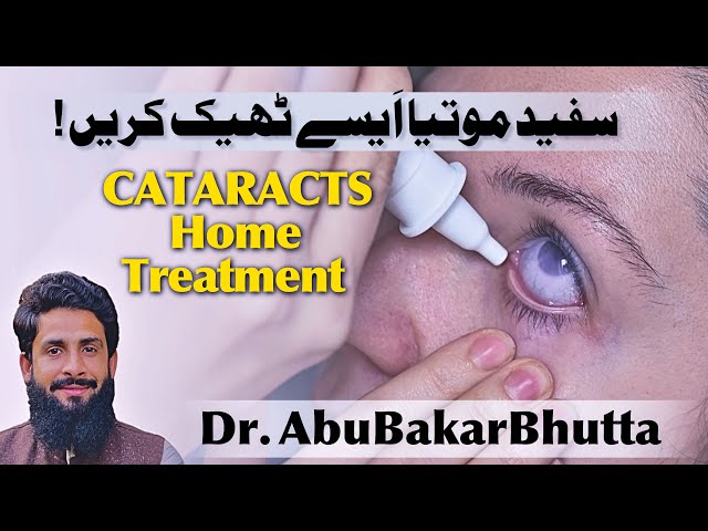 The Best Remedy for Cataracts | kefir Benefits | سفید موتیا کا گھر میں علاج