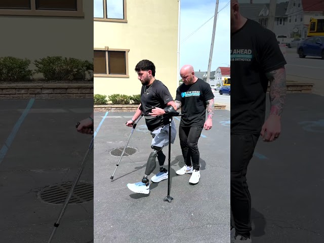 Ariel's Progress with Bilateral Above-Knee Prosthetics