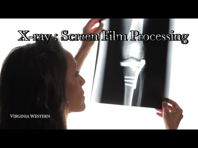 Xray Film Screen Processing