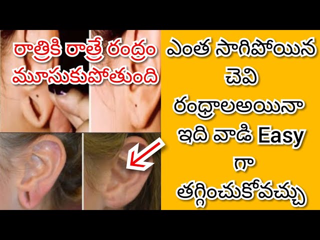 How to Shrink Earlobes