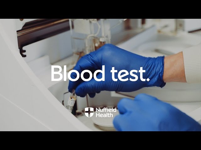 Blood Test Procedure | Nuffield Health