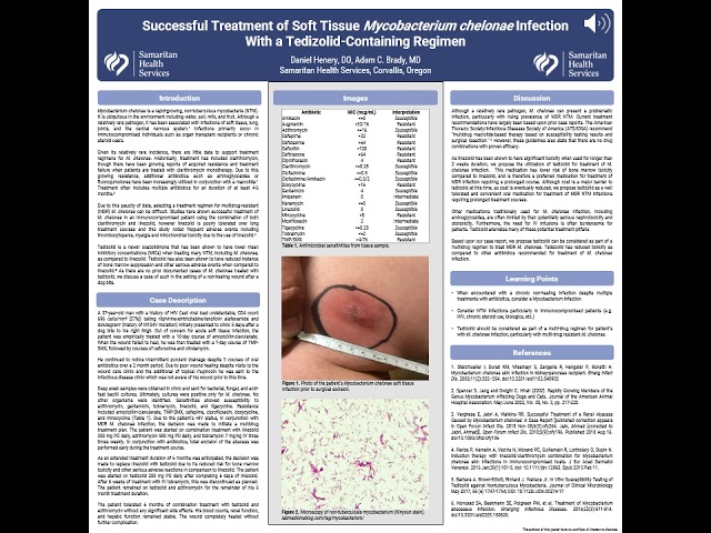 Treatment of Soft Tissue Mycobacterium chelonae Infection With a Tedizolid-Containing Regimen