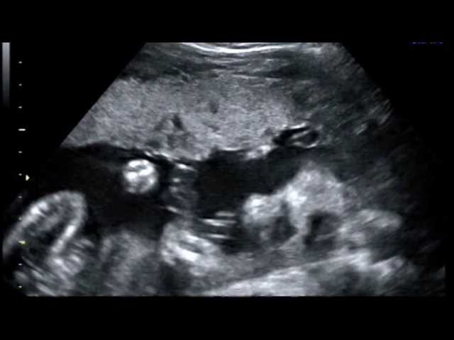 Pro-Life