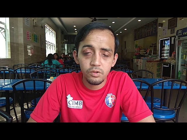 Kapten Pasukan Bola Sepak Orang Buta Malaysia Rayu Bantuan Demi Persiapan Paralimpik Tokyo 2020