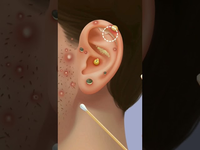 ear treatment 😮💥 #shorts #asmr #games #treatment #viral