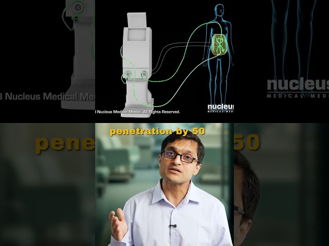 HIPEC: Cancer Surgery With Heated Chemo #hipec #cancertreatment #cancerawareness #cancer #medical