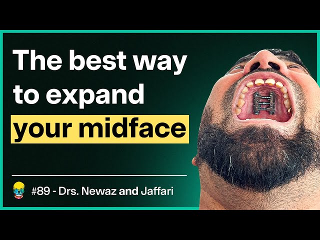This Orthodontist Expanded His Maxilla 9mm with FME | #89 Dr. Newaz and Dr. Jaffari