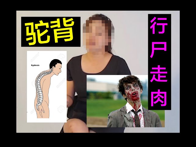 驼背 + 行尸走肉的小孩