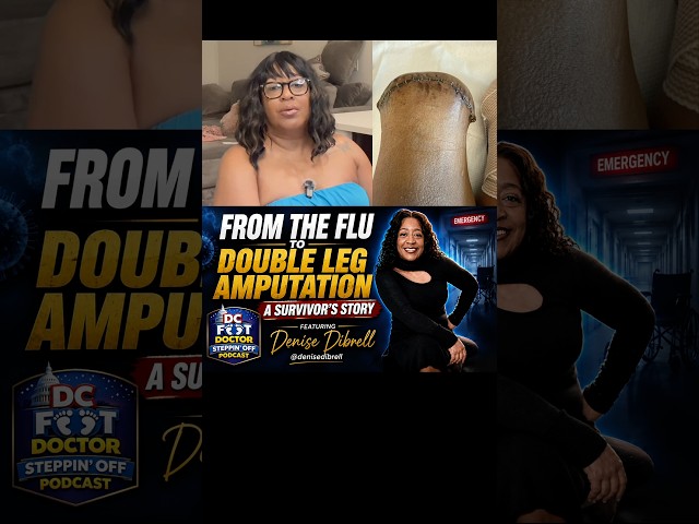Surviving septic shock and double leg amputation @Denisedibrell #survivor #amputee #septicshock