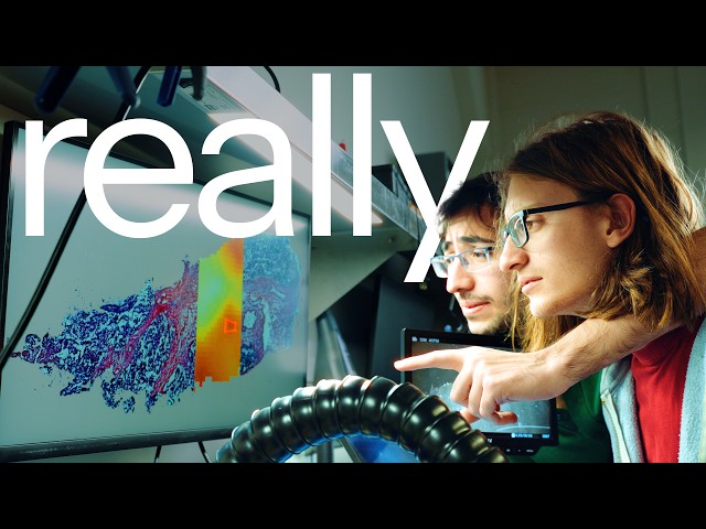 they made an AI model that finds tumors