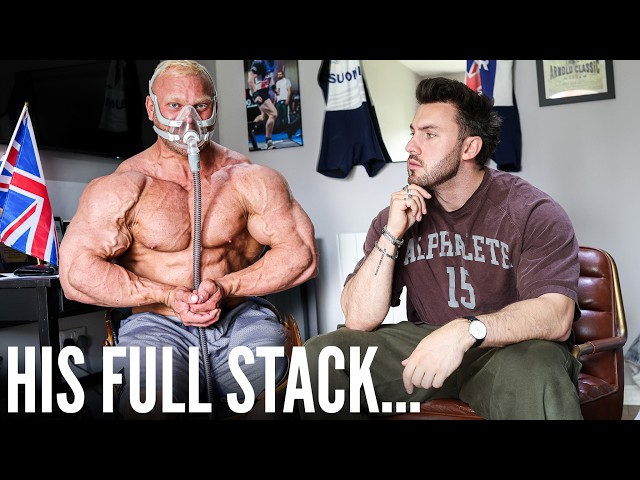 The Anabolic Stack Of A 21 Year Old Bodybuilder (250lbs At 21)