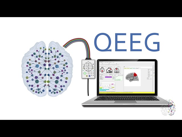 QEEG Explained - How Does A QEEG Brain Scan Work?