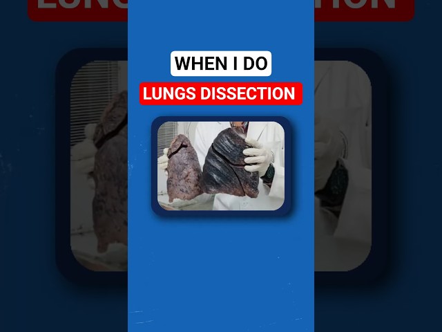 Lungs DISECTION in AIIMS DELHI #shorts #shortsfeed