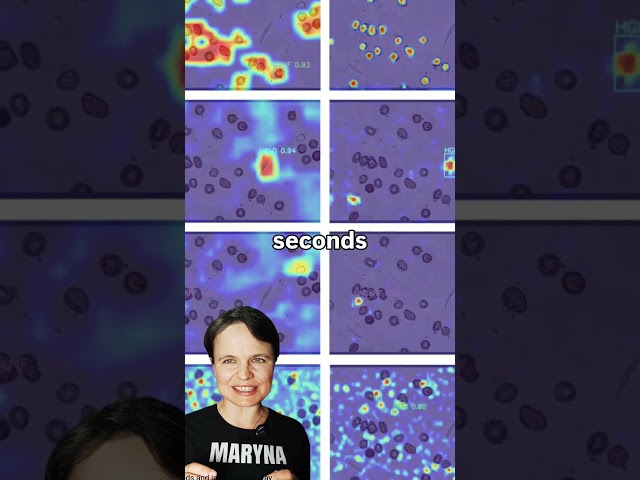 AI for fungal spores count