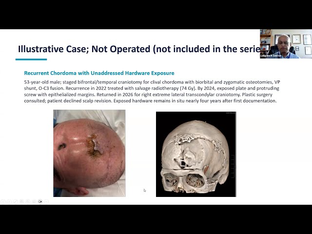 7.8.2026 Laligam N. Sekhar, MD, FACS, FAANS