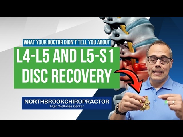 What Your Doctor Didn’t Tell You About L4-L5 and L5-S1 Disc Recovery