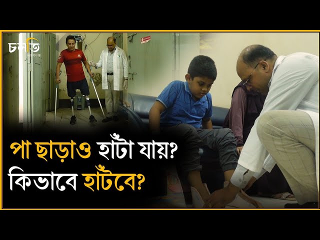 হাত নে'ই...? পা নে'ই...? সব কিছু ভেবে কান্না পেলো | চলতি 