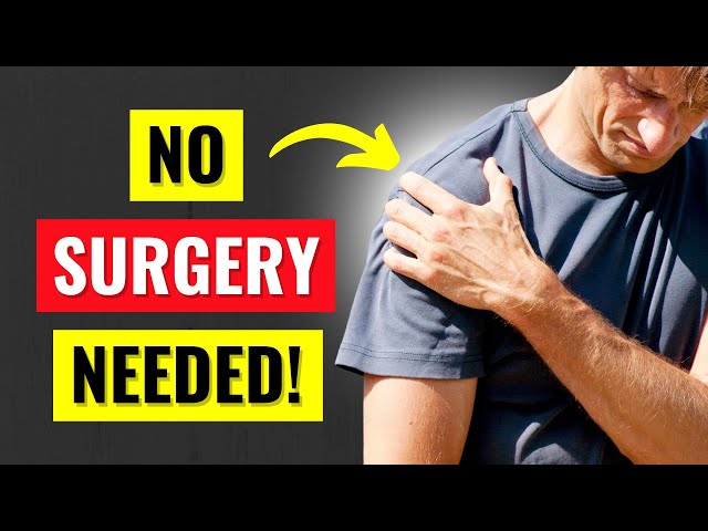 How to Heal a Rotator Cuff Tear Without Surgery