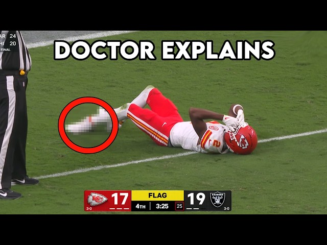 Tyquan Thornton Horrific Ankle Injury After Big Catch - Doctor Explains