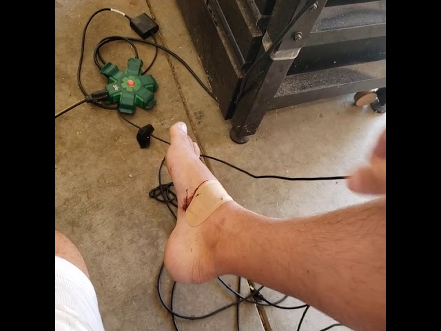 Ouch!!!!