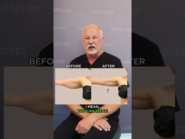 Dr. Hagstrom AirSculpt Sacramento