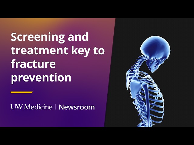 Screening and treatment key to fracture prevention