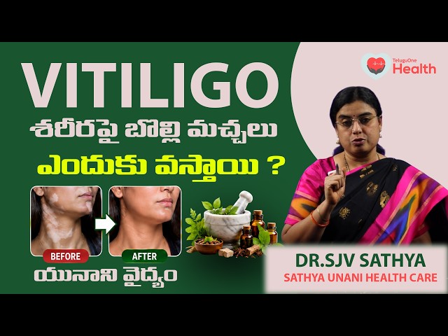 శరీరంపై తెల్ల మచ్చలు (White Spots) ఎందుకు వస్తాయి? పూర్తి వివరణ | Dr.Sjv Sathya | teluguone health